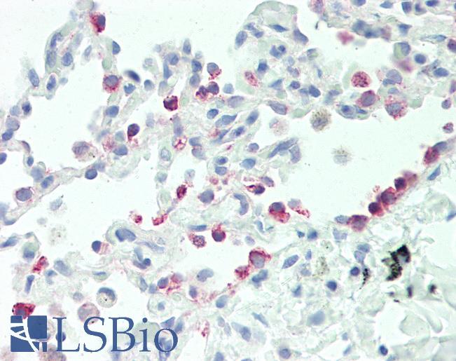Anti-CYP2B6 antibody IHC staining of human lung. Immunohistochemistry of formalin-fixed, paraffin-embedded tissue after heat-induced antigen retrieval.