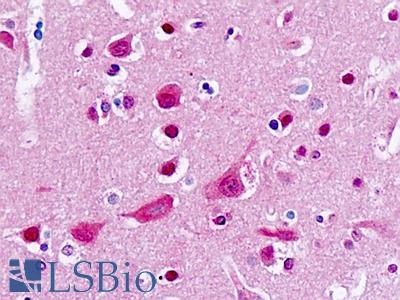 Anti-CYP2B6 antibody IHC staining of human brain, cortex. Immunohistochemistry of formalin-fixed, paraffin-embedded tissue after heat-induced antigen retrieval.