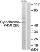 Western blot of extracts from HT-29 cells, using Cytochrome P450 2B6 Antibody. The lane on the right is treated with the synthesized peptide.