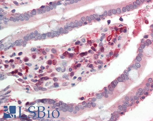Anti-CYP2C18 / CYP2C antibody IHC staining of human small intestine. Immunohistochemistry of formalin-fixed, paraffin-embedded tissue after heat-induced antigen retrieval. Antibody LS-B11483 concentration 10 ug/ml.