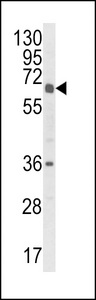 Western blot of CYP2C18 Antibody in HL-60 cell line lysates (35 ug/lane). CYP2C18 (arrow) was detected using the purified antibody.