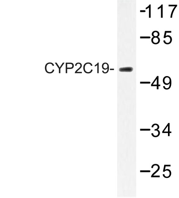 Western blot of CYP2C19 (K270) pAb in extracts from 293 cells.