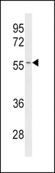 Western blot of CYP2C19 Antibody in Jurkat cell line lysates (35 ug/lane). CYP2C19 (arrow) was detected using the purified antibody.