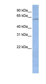 CYP2C19 antibody LS-C110653 Western blot of Placenta lysate.