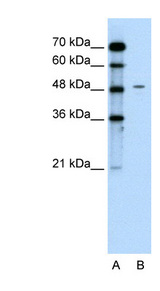 CHGA / Chromogranin A antibody LS-B1515 Western blot of Jurkat lysate.