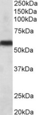 CYP2C8 antibody (0.1 ug/ml) staining of Human Liver lysate (35 ug protein in RIPA buffer). Primary incubation was 1 hour. Detected by chemiluminescence.