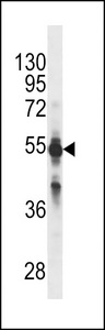 CYP2C9 Antibody (Ascites)western blot of NCI-H460 cell line lysates (35 ug/lane). The CYP2C9 antibody detected the CYP2C9 protein (arrow).