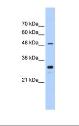Jurkat cell lysate. Antibody concentration: 0.25 ug/ml. Gel concentration: 12%.