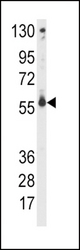 Western blot of anti-CYP2C9 Antibody in CEM cell line lysates (35 ug/lane). CYP2C9(arrow) was detected using the purified antibody.