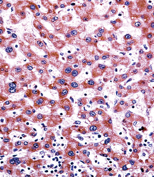 CYP2C9 Antibody immunohistochemistry of formalin-fixed and paraffin-embedded human liver tissue followed by peroxidase-conjugated secondary antibody and DAB staining.