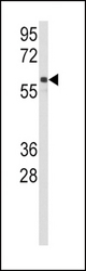 Western blot of anti-CYP2C9 Antibody in Jurkat cell line lysates (35 ug/lane). CYP2C9(arrow) was detected using the purified antibody.