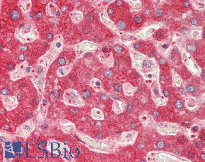 Human Liver: Formalin-Fixed, Paraffin-Embedded (FFPE)