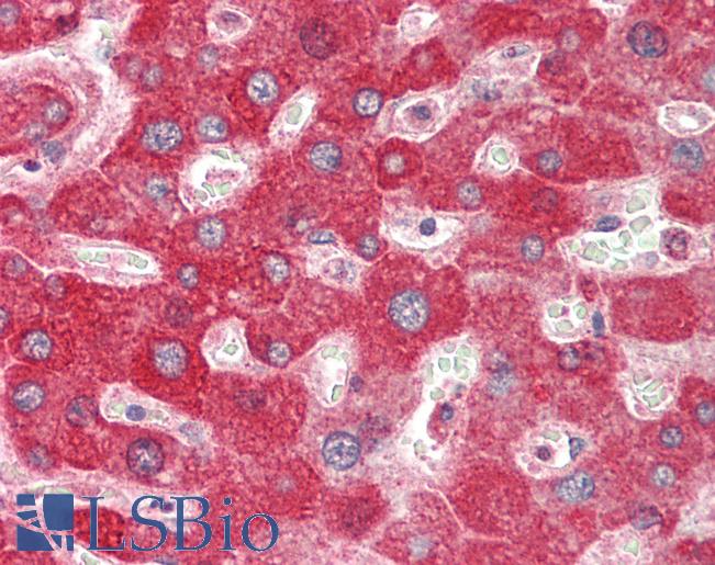 Human Liver: Formalin-Fixed, Paraffin-Embedded (FFPE)