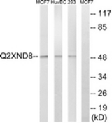 Western blot of extracts from 293/HUVEC/MCF-7 cells, using Cytochrome P450 2D6 Antibody. The lane on the right is treated with the synthesized peptide.