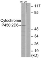 Western blot of extracts from HT-29 cells, using Cytochrome P450 2D6 Antibody. The lane on the right is treated with the synthesized peptide.