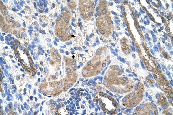 CYP2D6 antibody LS-C40339 IHC of formalin-fixed, paraffin-embedded human Kidney. Positive label: Epithelial cells of renal tubule indicated with arrows. Antibody concentration 4-8 ug/ml. Magnification 400X.