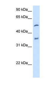 CYP2D6 antibody LS-C40339 Western blot of Fetal Liver lysate.