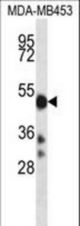 CYP2D6 Antibody western blot of MDA-MB453 cell line lysates (35 ug/lane). The CYP2D6 antibody detected the CYP2D6 protein (arrow).