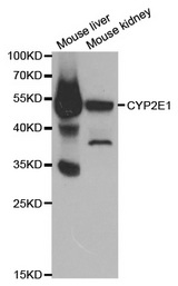 Western blot analysis of extracts of various cell lines, using CYP2E1 antibody.