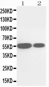 WB of CYP2E1 antibody. Lane 1: Rat Liver Tissue Lysate. Lane 2: Mouse Liver Tissue Lysate.