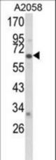 Western blot of CYP2F1 Antibody in A2058 cell line lysates (35 ug/lane). CYP2F1 (arrow) was detected using the purified antibody.