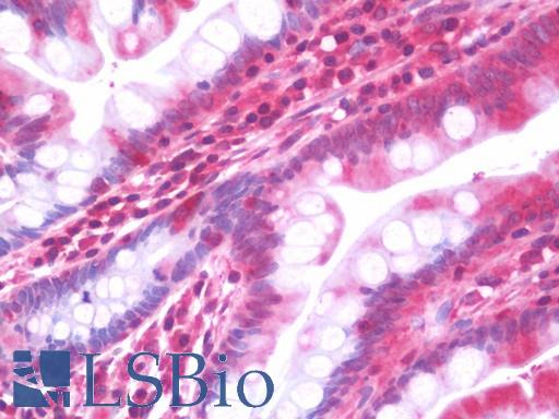 Anti-CYP2F / CYP2F1 antibody IHC staining of human small intestine. Immunohistochemistry of formalin-fixed, paraffin-embedded tissue after heat-induced antigen retrieval. Antibody LS-B10872 concentration 7.5 ug/ml.