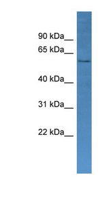 CYP2J2 antibody LS-C135720 Western blot of Fetal Heart lysate.