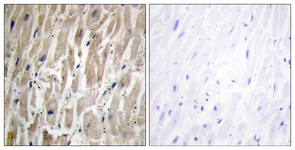IHC of paraffin-embedded human heart tissue, using Cytochrome P450 2J2 Antibody. The picture on the right is treated with the synthesized peptide.