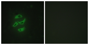 Immunofluorescence of HepG2 cells, using Cytochrome P450 2J2 Antibody. The picture on the right is treated with the synthesized peptide.