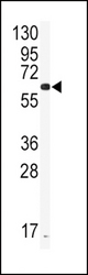 Western blot of anti-CYP2J2 Antibody in CEM cell line lysates (35 ug/lane). CYP2J2 (arrow) was detected using the purified antibody.