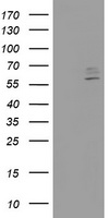HEK293T cells were transfected with the pCMV6-ENTRY control (Left lane) or pCMV6-ENTRY CYP2J2 (Right lane) cDNA for 48 hrs and lysed. Equivalent amounts of cell lysates (5 ug per lane) were separated by SDS-PAGE and immunoblotted with anti-CYP2J2.