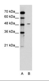 A: Marker, B: Jurkat Cell Lysate