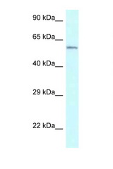 CYP2U1 antibody LS-C145573 Western blot of Jurkat Cell lysate. Antibody concentration 1 ug/ml.