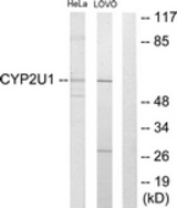 Western blot of extracts from HeLa/Lovo cells, using Cytochrome P450 2U1 Antibody. The lane on the right is treated with the synthesized peptide.