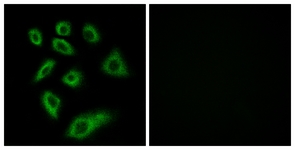 Immunofluorescence of HUVEC cells, using Cytochrome P450 2W1 Antibody. The picture on the right is treated with the synthesized peptide.
