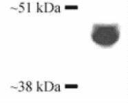 Western blot of cytochrome P450 (3A4 isoforms) on rat liver extract.