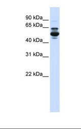 Fetal liver lysate. Antibody concentration: 1.0 ug/ml. Gel concentration: 12%.