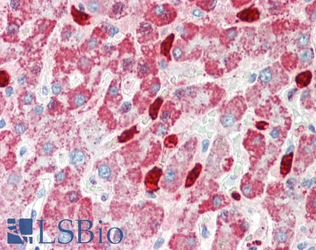 Human, Liver: Formalin-Fixed Paraffin-Embedded (FFPE)