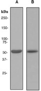 Western blot analysis on (A) fetal liver and (B) fetal colon lysates using anti-Cytochrome P450 3A5 antibody.