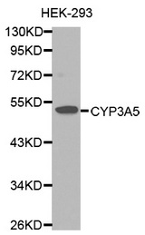 Western blot analysis of extracts of HEK-293 cells lines, using CYP3A5 antibody.