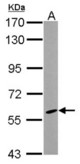 Sample (30 ug of whole cell lysate) A: MCF-7 7.5% SDS PAGE CYP46A1 antibody diluted at 1:1000