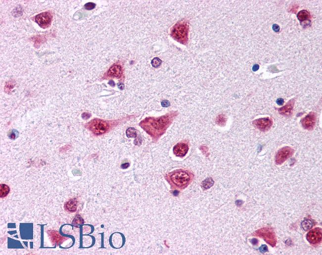 Anti-CYP46A1 antibody IHC of human brain, cortex. Immunohistochemistry of formalin-fixed, paraffin-embedded tissue after heat-induced antigen retrieval. Antibody LS-B279 dilution 1:500.