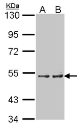 Sample (30 ug of whole cell lysate). A: A431, B: H1299. 7.5% SDS PAGE. CYP4A11 antibody diluted at 1:100