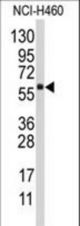 Western blot of anti-CYP4F12 Antibody in NCI-H460 cell line lysates (35 ug/lane). CYP4F12(arrow) was detected using the purified antibody.