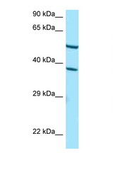 CYP4F2 antibody LS-C146501 Western blot of HepG2 Cell lysate. Antibody concentration 1 ug/ml.