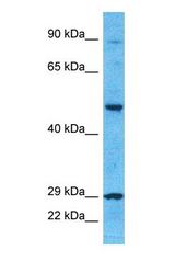Western blot of CP4F8 Antibody with human 786-0 Whole Cell lysate.