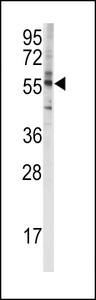 Western blot of anti-CYP4F8 Antibody in K562 cell line lysates (35 ug/lane). CYP4F8(arrow) was detected using the purified antibody.