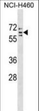CYP4V2 Antibody western blot of NCI-H460 cell line lysates (35 ug/lane). The CYP4V2 antibody detected the CYP4V2 protein (arrow).