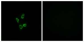 Immunofluorescence of HUVEC cells, using Cytochrome P450 4Z1 Antibody. The picture on the right is treated with the synthesized peptide.