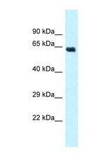 CYP4Z1 antibody LS-C145780 Western blot of Fetal Heart lysate. Antibody concentration 1 ug/ml.